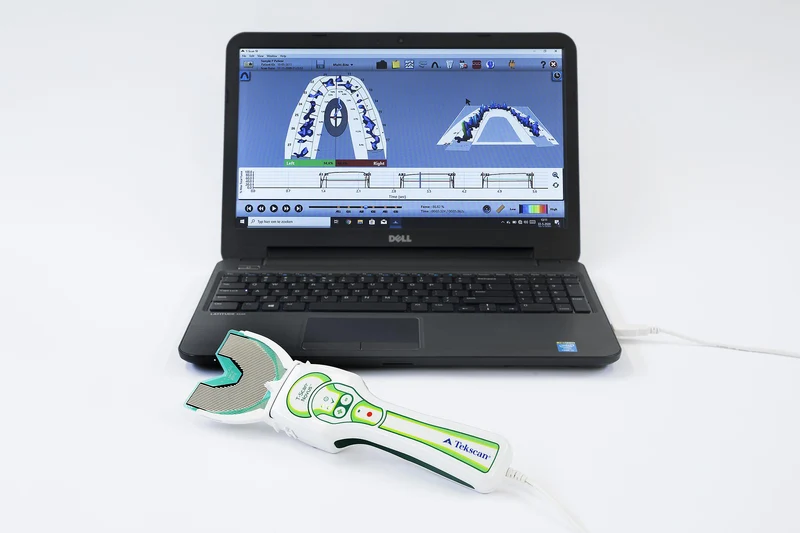 T-Scan Novus® Core® System